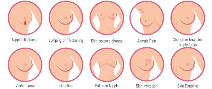 Three Steps To Self Exam The Breast